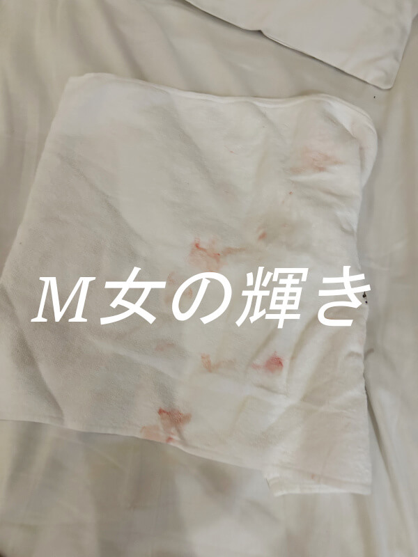 性のトラウマ女性の処女卒業体験のみあさん出血